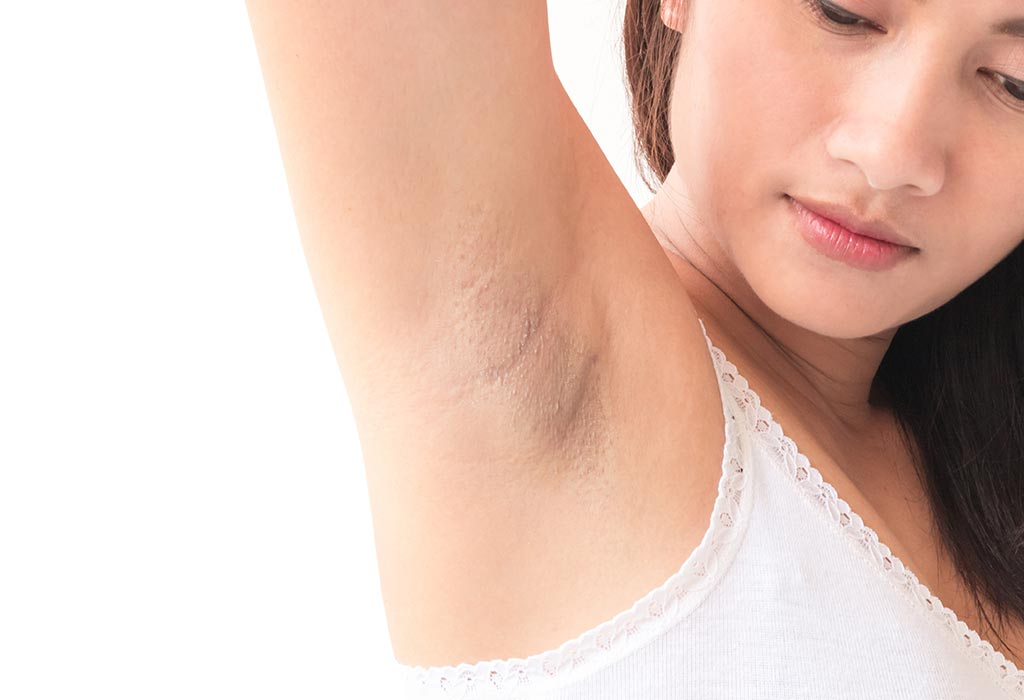 5 Proven Ways To Lighten Your Underarms Need Circle 