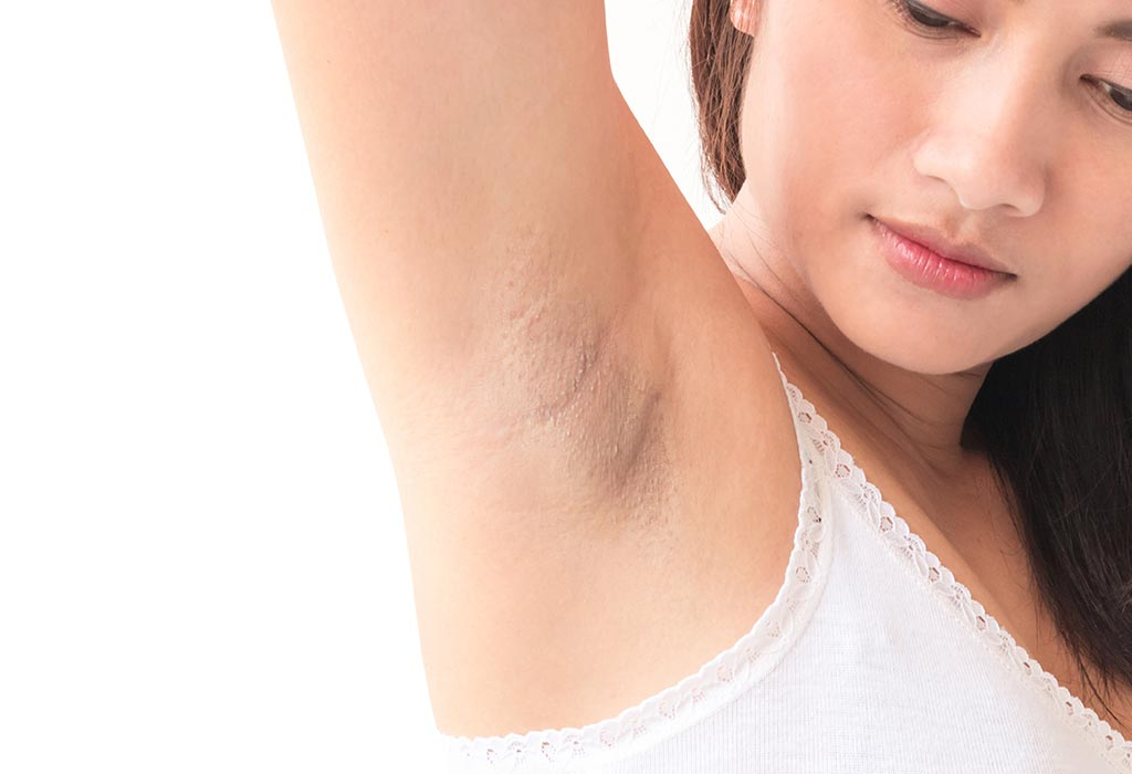 5-proven-ways-to-lighten-your-underarms-need-circle